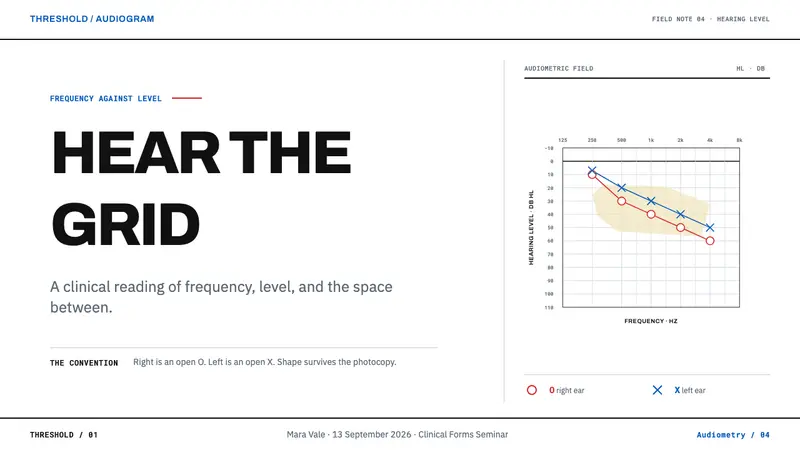 Audiogram Chart — Slides · cover