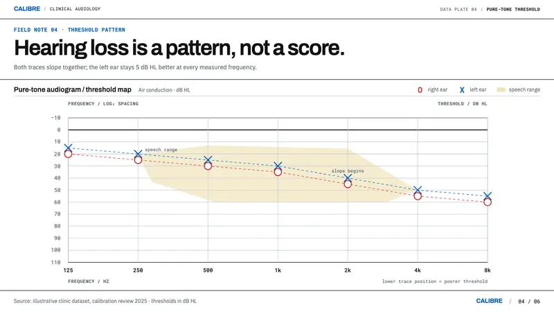 Audiogram Chart — Slides · data