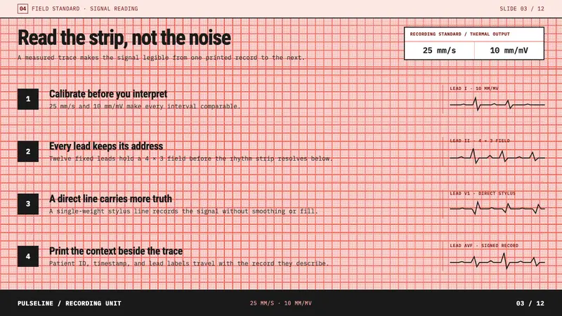 ECG Strip Paper — Slides · content