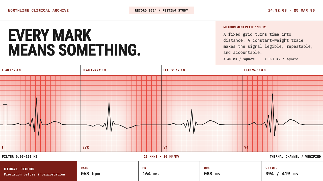 ECG Strip Paper design style — example