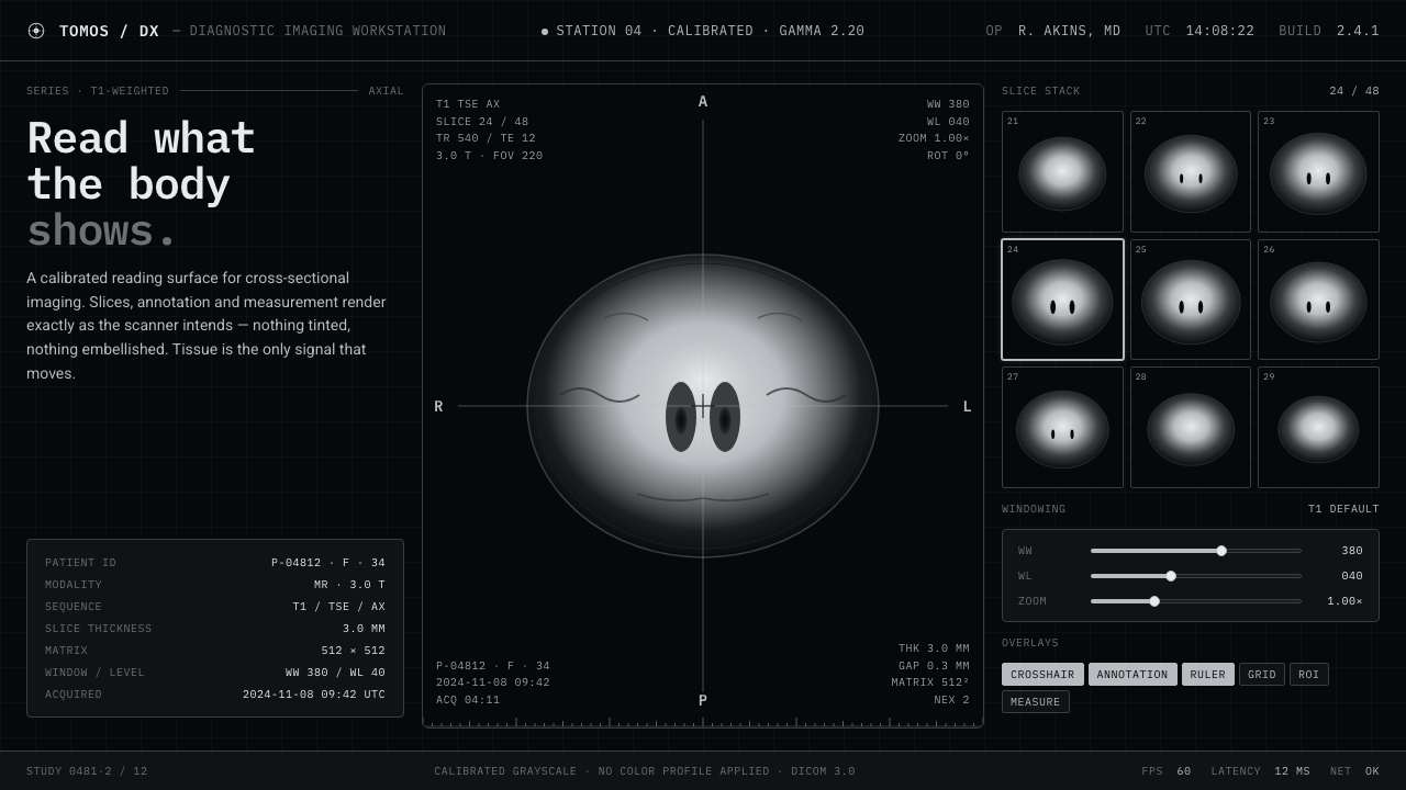 MRI Scan design style